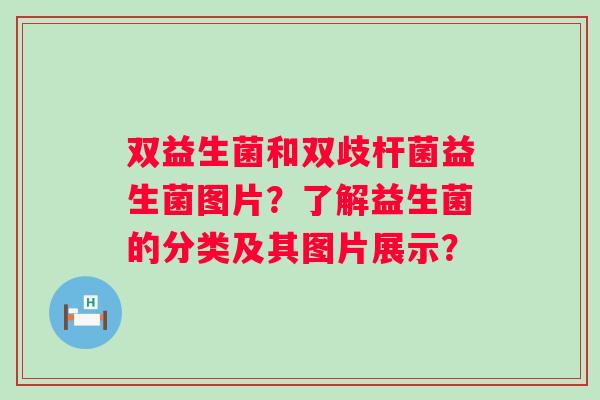 双益生菌和双歧杆菌益生菌图片?了解益生菌的分类及其图片展示? 双益生菌和双歧杆菌益生菌图片?了解益生菌的分类及其图片展示?