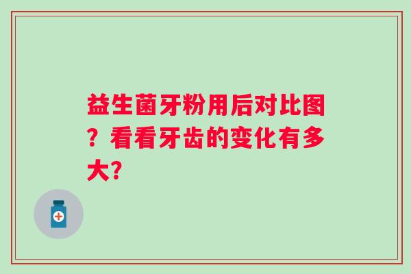 益生菌牙粉用后对比图？看看牙齿的变化有多大？