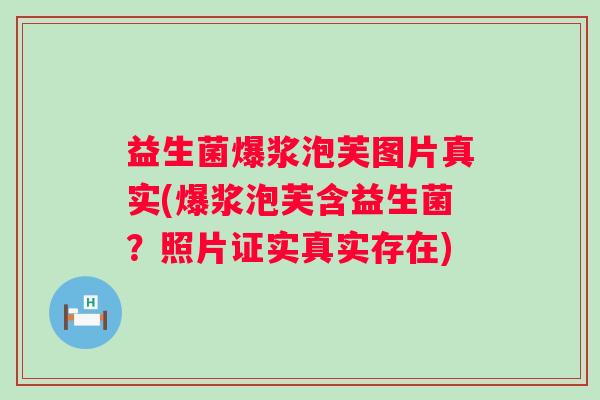 益生菌爆浆泡芙图片真实(爆浆泡芙含益生菌?照片证实真实存在) 益生菌爆浆泡芙图片真实(爆浆泡芙含益生菌?照片证实真实存在)