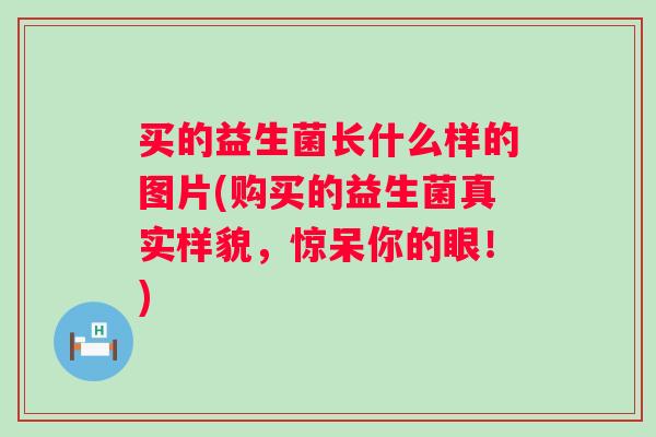 买的益生菌长什么样的图片(购买的益生菌真实样貌,惊呆你的眼!) 买的益生菌长什么样的图片(购买的益生菌真实样貌,惊呆你的眼!)