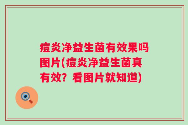 痘炎净益生菌有效果吗图片(痘炎净益生菌真有效？看图片就知道)