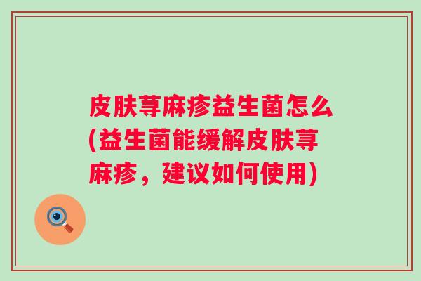 荨麻疹益生菌怎么(益生菌能缓解荨麻疹,建议如何使用) 荨麻疹益生菌怎么(益生菌能缓解荨麻疹,建议如何使用)